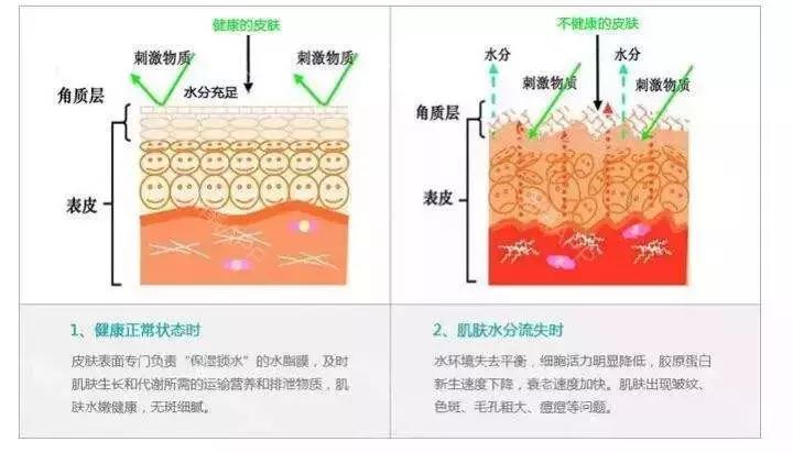 头皮痒头屑多是脂溢性皮炎,头皮油又痒头皮屑多是怎么回事