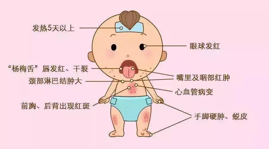 孩子扁桃体发炎连续三天高烧不退,老人连续几天高烧不退怀疑什么病