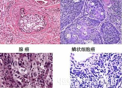 外科医生切下来的肉都到哪了,医生割下来的肉去哪里了