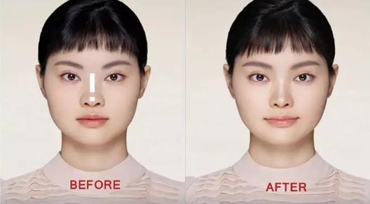 塌鼻子怎么变成方脸,五官扁平塌鼻子如何改善