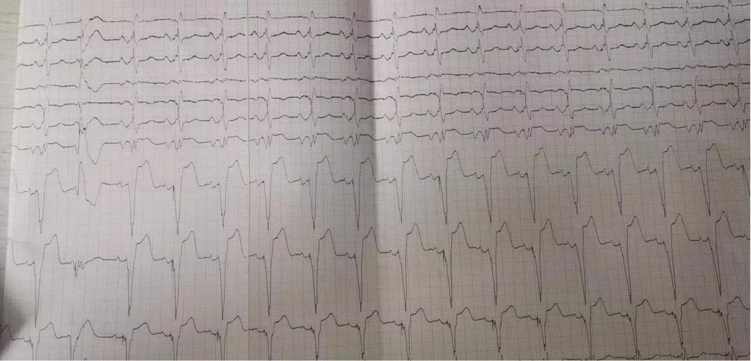 患者的治疗方案？患者的选择或是医生的选择，如何选择最优解？
