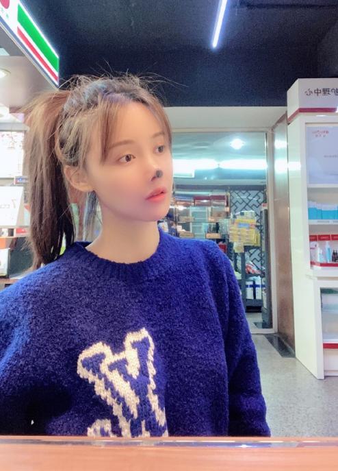 95后整容女艺人,高溜整容失败案例