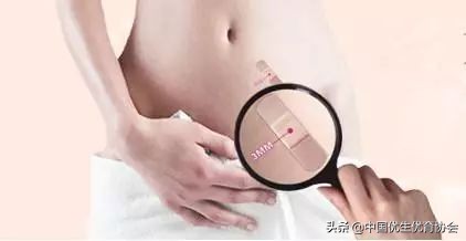 【听刘大夫说】宫腔镜手术后多久可以怀孕？