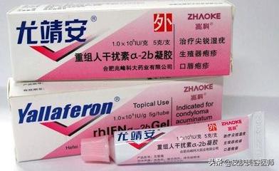 病毒疣最可靠的外涂药物,病毒疣的中药药方