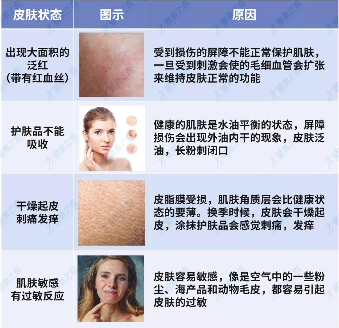 洗脸洗多了脸疼怎么办,如何正确洗脸你洗对了吗