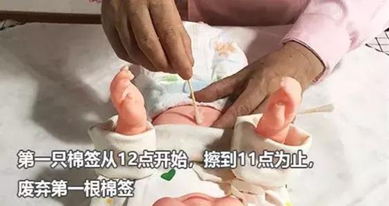 新生儿脐带一个月还没脱落正常吗,新生儿脐带一个月还没掉正常吗