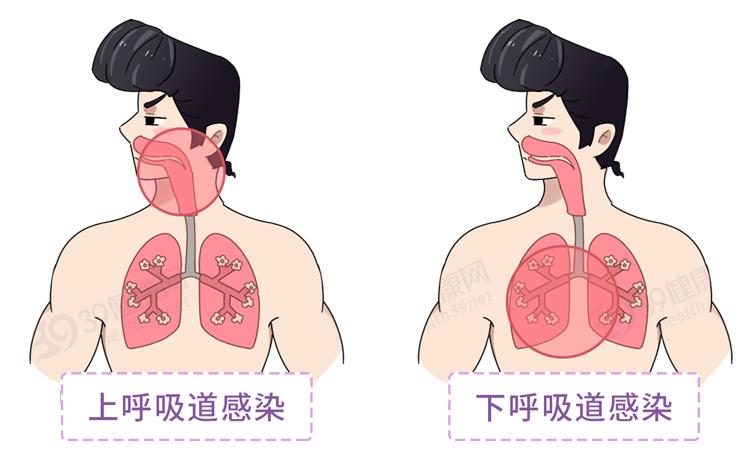 喉咙不舒服咳嗽慢性咽炎,咽喉异物感咳不出咽不下吃什么药