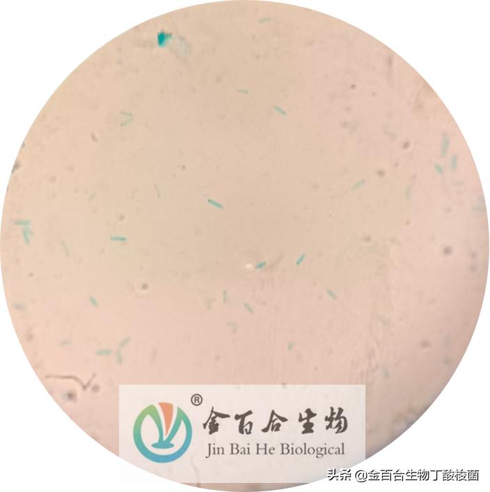 革兰氏染色显微镜下的图手绘,革兰染色用的显微镜是什么