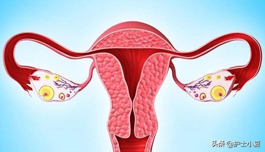 女人得了盆腔炎症该关注哪些,盆腔炎怎么预防和改善