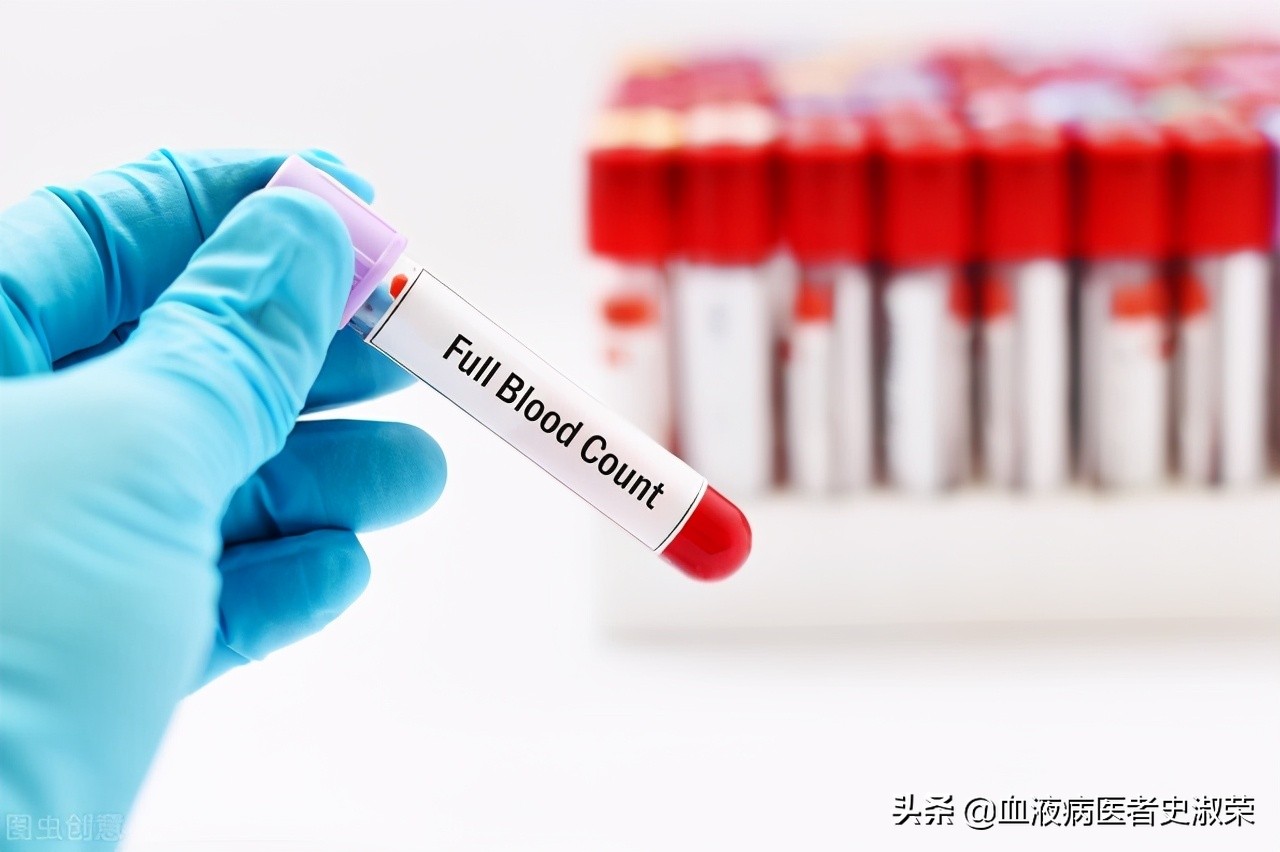 免疫性血小板减少症中医有效吗,血小板减少性紫癜的中医药治疗