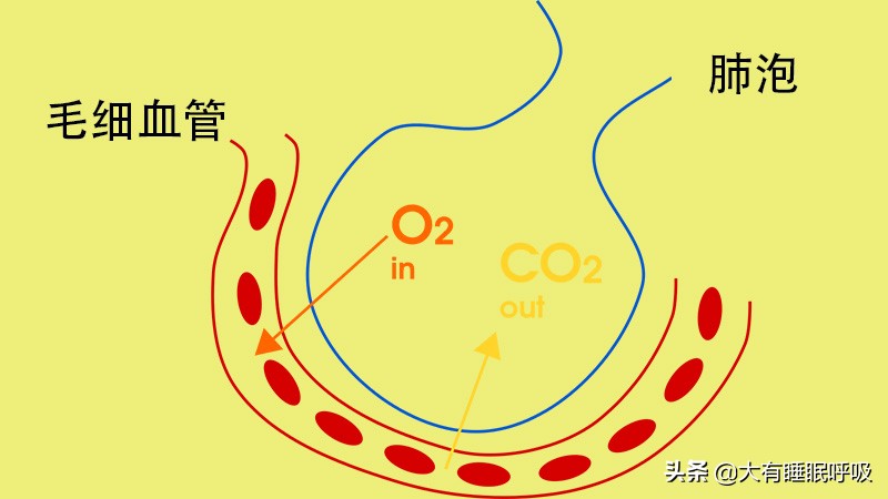 使用呼吸机对慢阻肺（肺气肿、肺心病）病人有什么作用