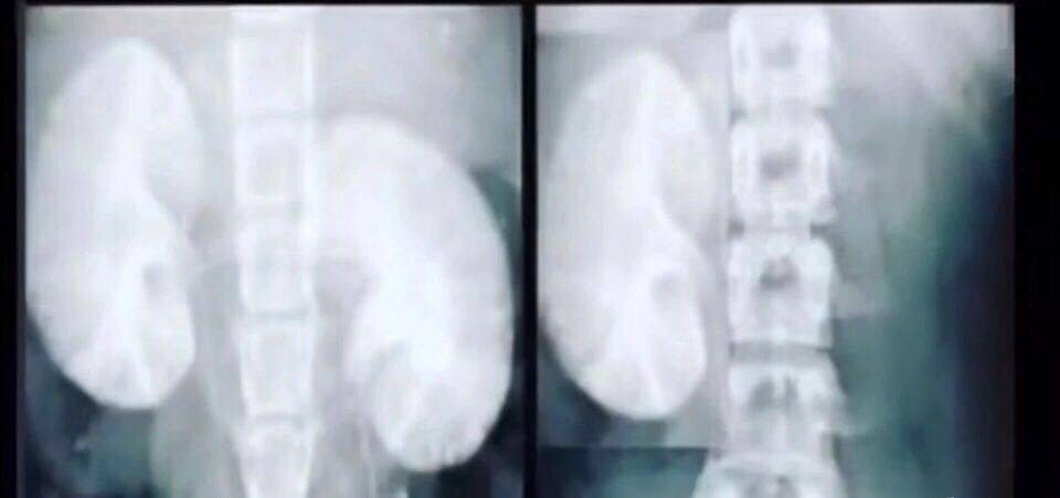 当代人最常见的亚健康表现,造成亚健康的原因有哪几个方面