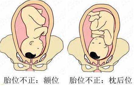 孕妈妈胎动太明显了,准妈妈为什么会出现胎动