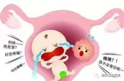 子宫腺性肌瘤有什么危害,子宫肌瘤是影响功能的良性肿瘤