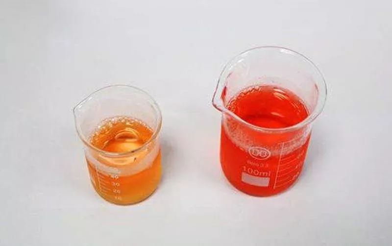 出现血尿就真的患了肾脏疾病吗？