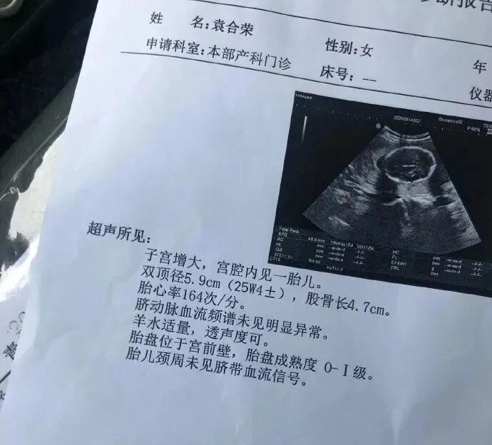 全身肌肉的白衣天使，因模仿“不知火舞”走红，孕期仍坚持健身？