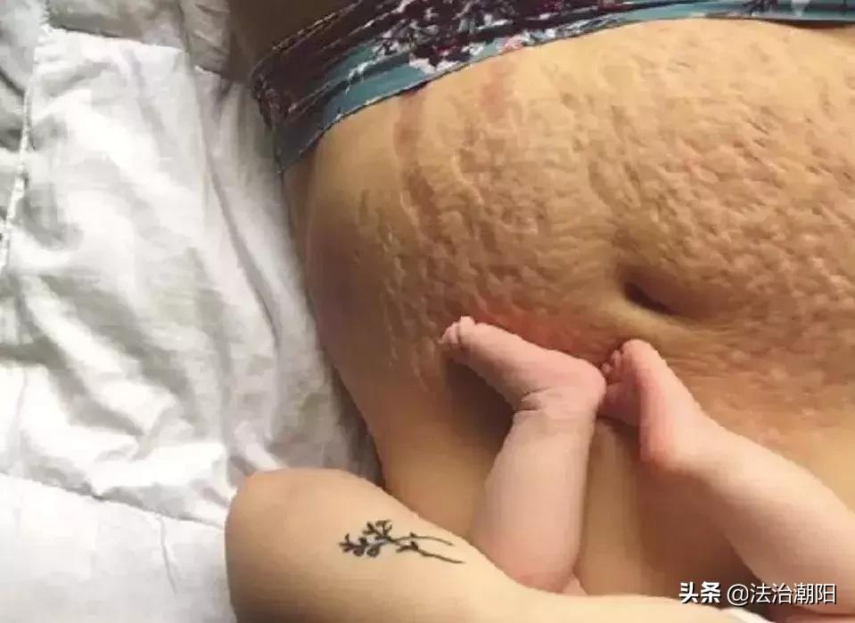 女明星自曝生儿子后“尿*禁失**”