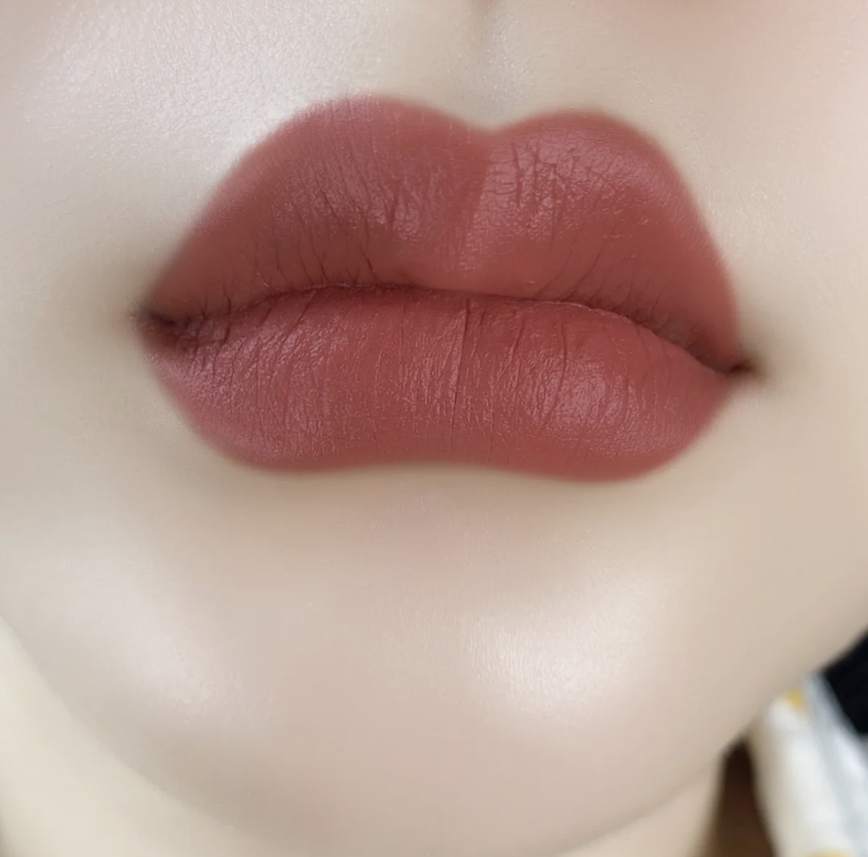 嘴唇经常又干又起皮是什么原因,嘴唇黑紫起干皮用什么