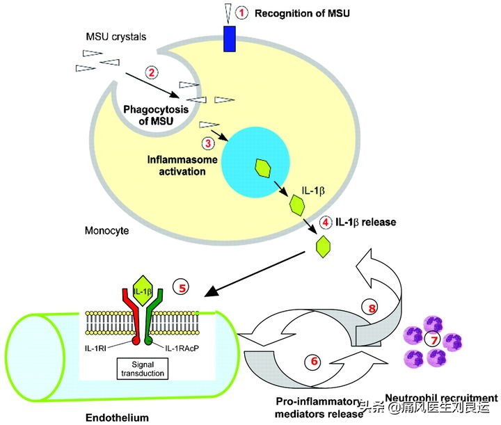 降尿酸可以使痛风结晶溶解吗,吃药降尿酸会损坏肾功能吗
