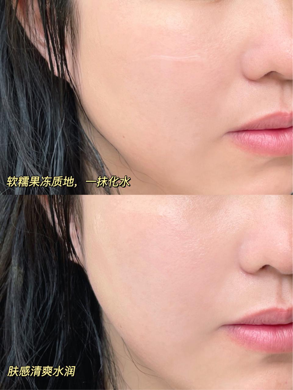适合皮肤泛红角质层薄的大牌面霜,换季补水抗皱面霜