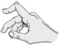 所有骨折都叫什么名字,骨折的名称有哪些