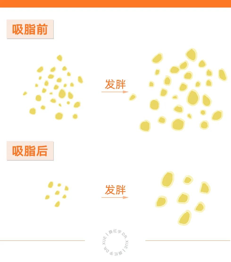 吸脂十天对比图,吸脂整形疑问解答视频大全