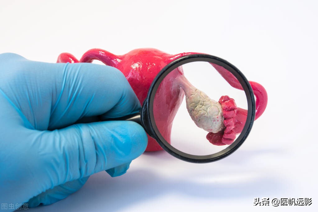 养好卵巢女人更美丽,卵巢健康图文