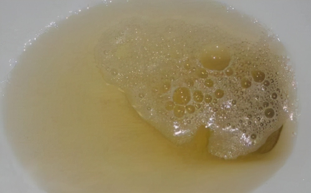 尿液黄色又难闻是啥原因,尿液很黄而且难闻怎么回事