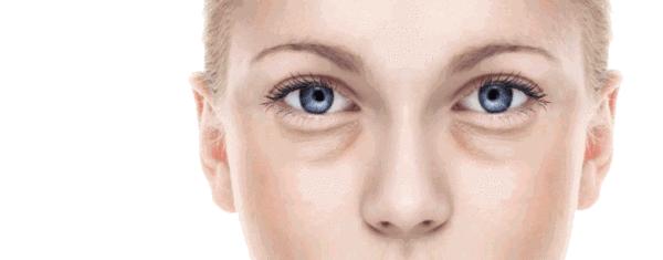 超级严重泪沟怎么遮瑕,超严重泪沟怎么遮