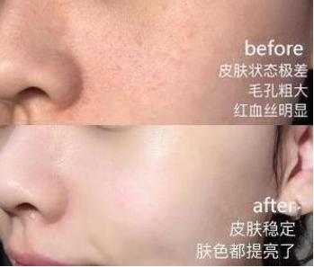 李佳琦推荐洗面奶和护肤品,李佳琦常用的护肤品有哪些