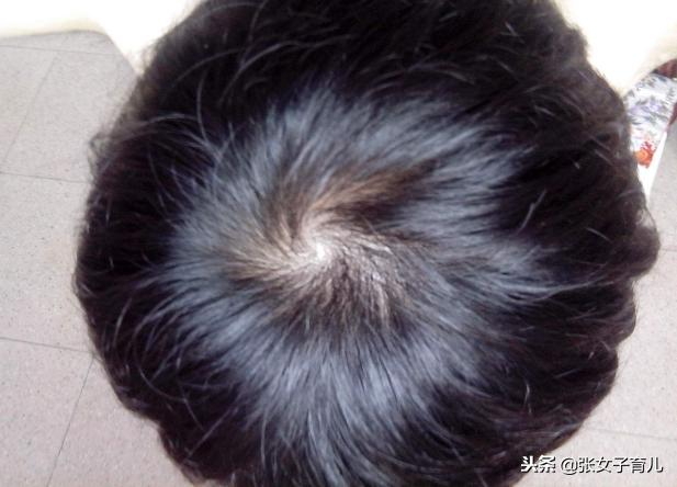 宝宝头旋处脑袋很平,宝宝脑袋跳动的叫什么