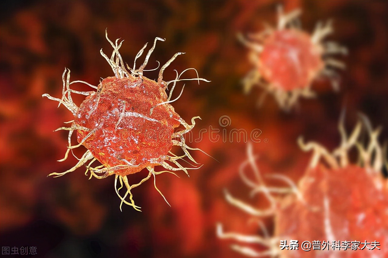 肺原位癌手术后要关注什么,肺癌原位癌手术切除后为何还复发