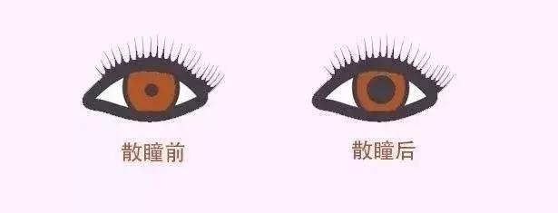 4岁孩子散光近视50度有影响吗,孩子近视警告