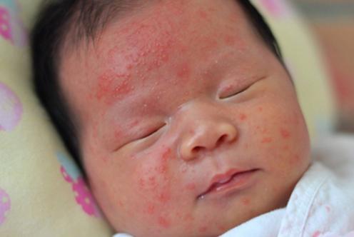 孕晚期吃鹅蛋怎么解胎毒,孕晚期吃鹅蛋可以去胎毒吗