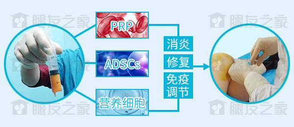 骨头软化能治好吗,髌骨软化骨头会长吗
