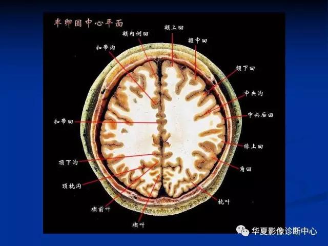 mra头颅解剖学详细讲解视频,常见的头颅mri图像