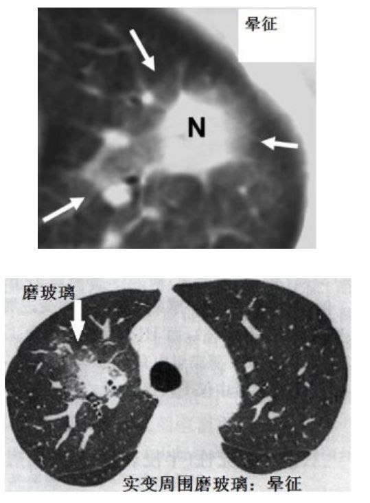 磨玻璃阴影怎么处理,磨玻璃阴影