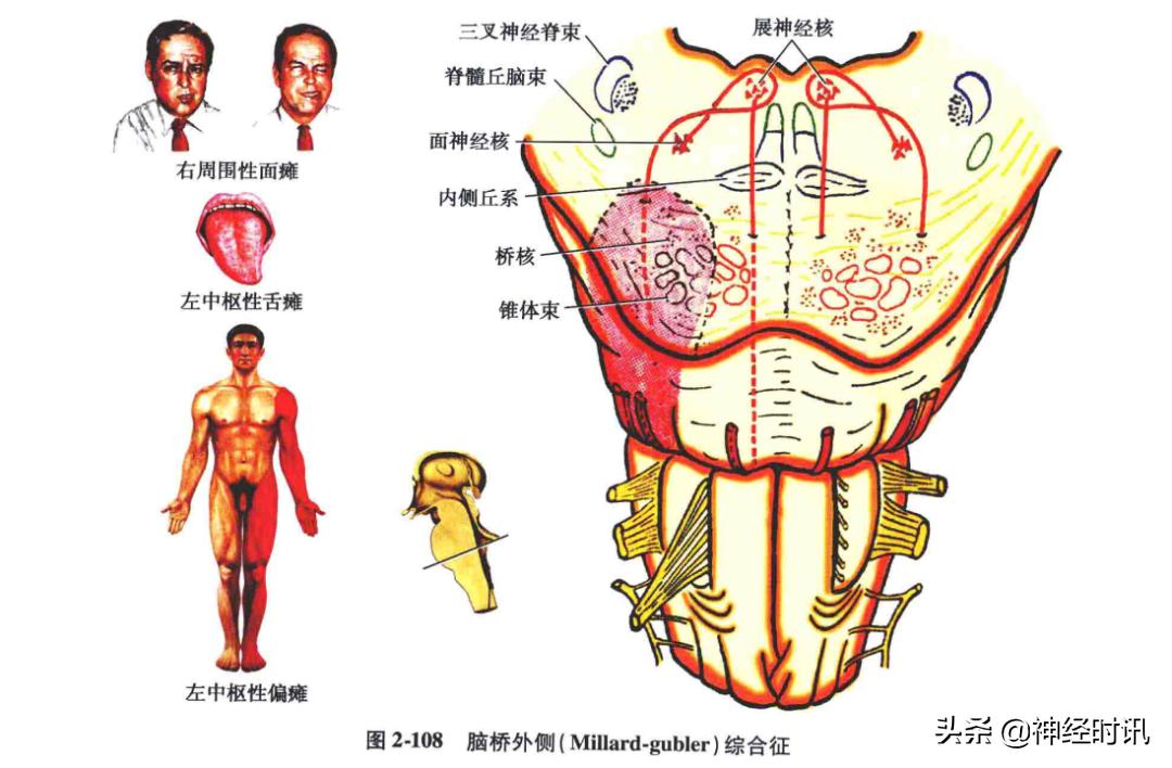 脑干解剖,脑干神经解剖