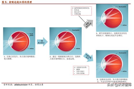 近视防控行业未来趋势,近视防控可行性报告