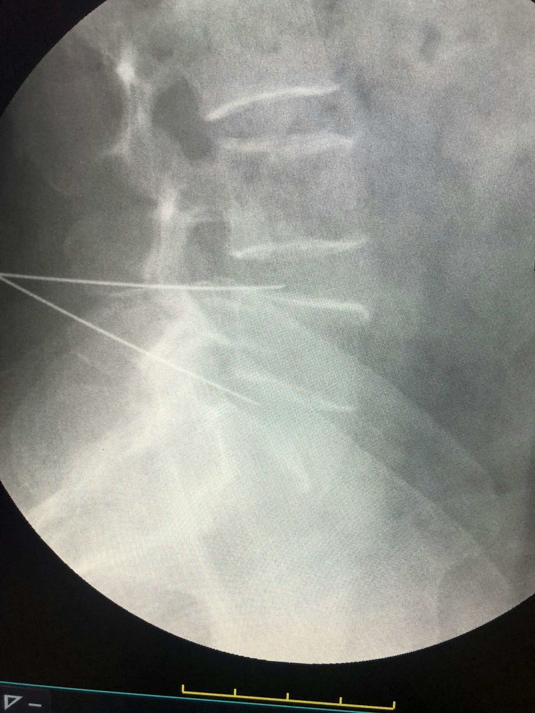 辉县骨科最好的医院是哪家,辉县市骨科医院