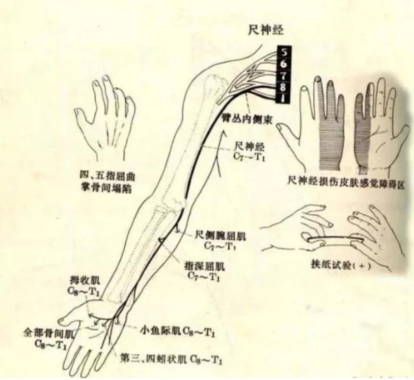 不谨慎磕到手了肿了,不谨慎磕到胳膊怎么办