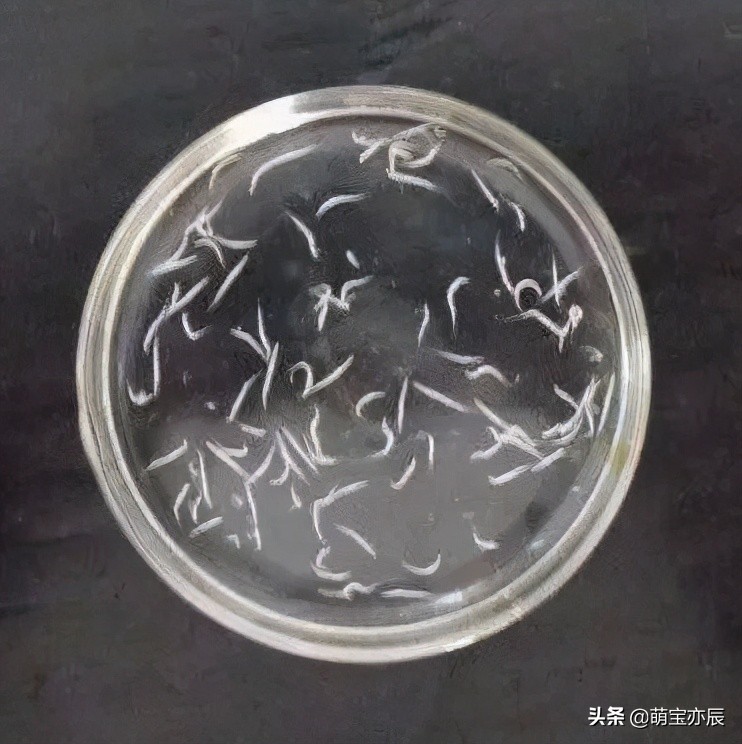 春天适合孩子驱虫吗,儿童春季驱虫选对驱虫药很重要