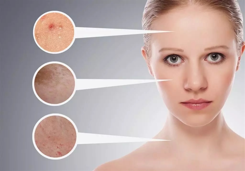 女人25岁应该怎样保养,35岁女人怎样保护皮肤