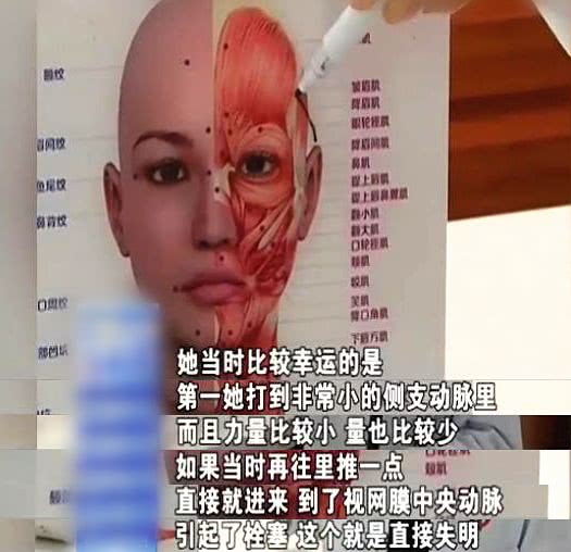 闂鸿湝鎵庨拡杈撴恫娴佽,闂鸿湝鎵撶幓灏块吀澶辨槑