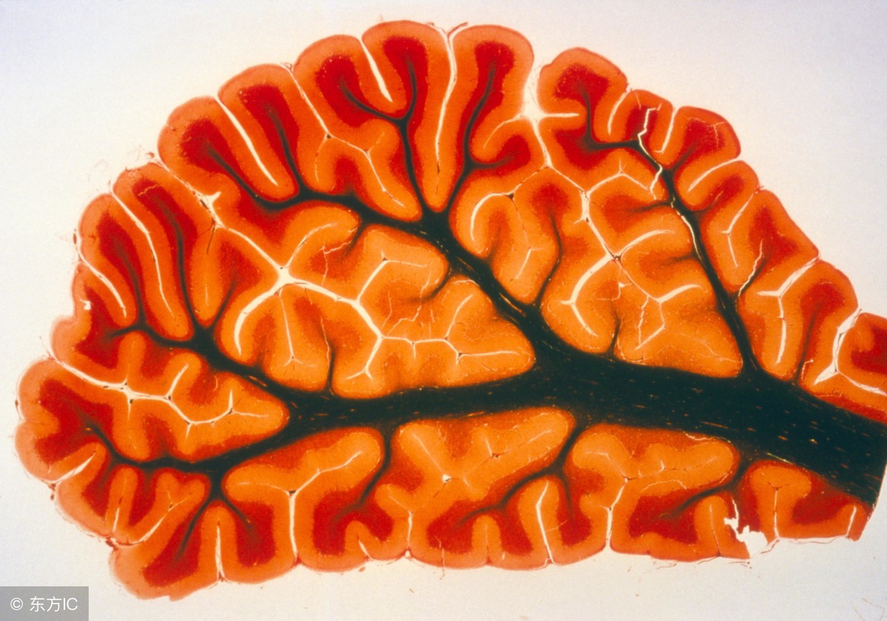 小脑萎缩犯法负法律责任吗,脑梗小脑萎缩什么方法治愈最好