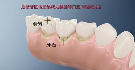 清洁钻石的方法,清洁钻石