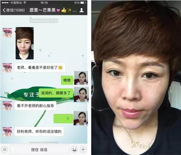 激素药造成皮肤发红能自愈吗,激素药导致皮肤发红能自愈吗