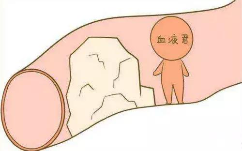 静脉曲张孕期需要关注什么,孕期打静脉曲张的针