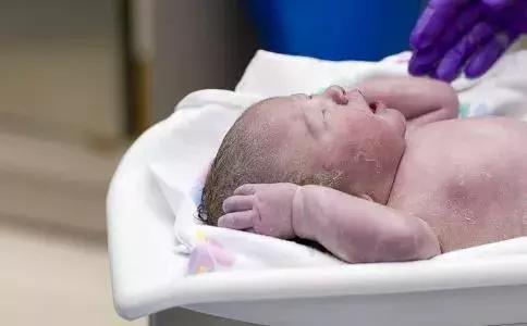 月嫂育婴师新生儿黄疸护理方法,月嫂怎样护理生理性黄疸