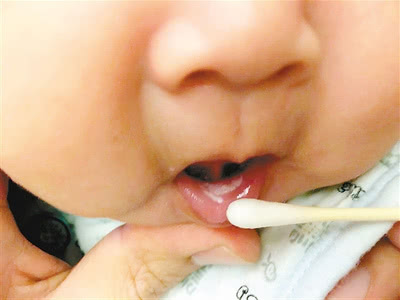 孕期有妇科炎症用治吗,孕期有妇科炎症用什么药好